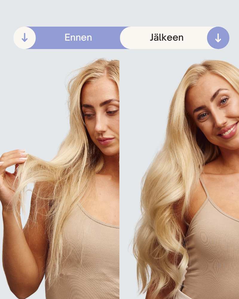 Tuotekuva 10